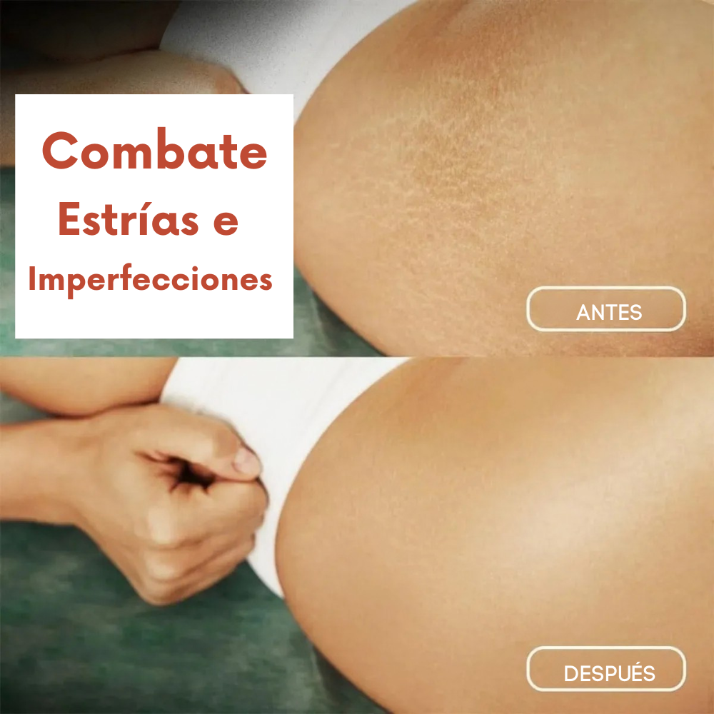 Magic Contour Oil – For Visible Cellulite Smoothing